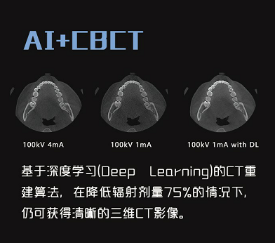 ai+cbct.png